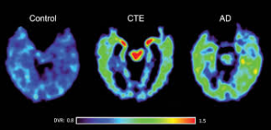 cte