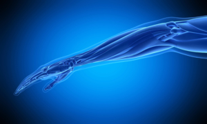 limb